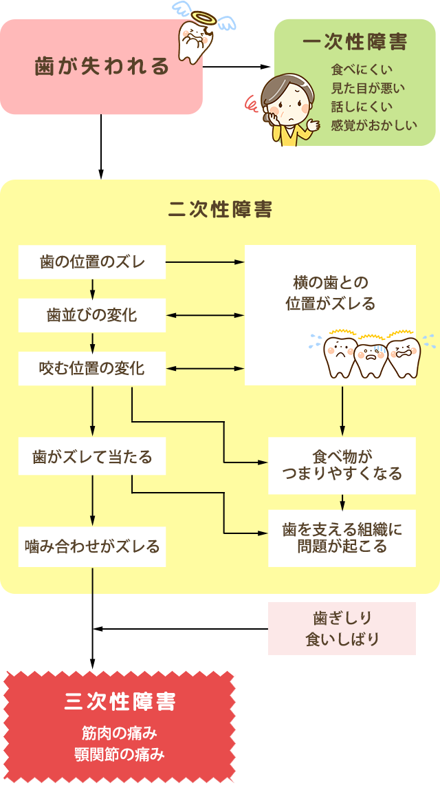 欠損補綴治療