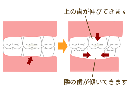 奥歯