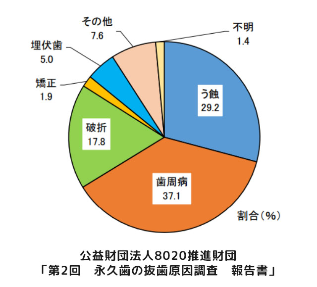 永久歯の抜歯原因